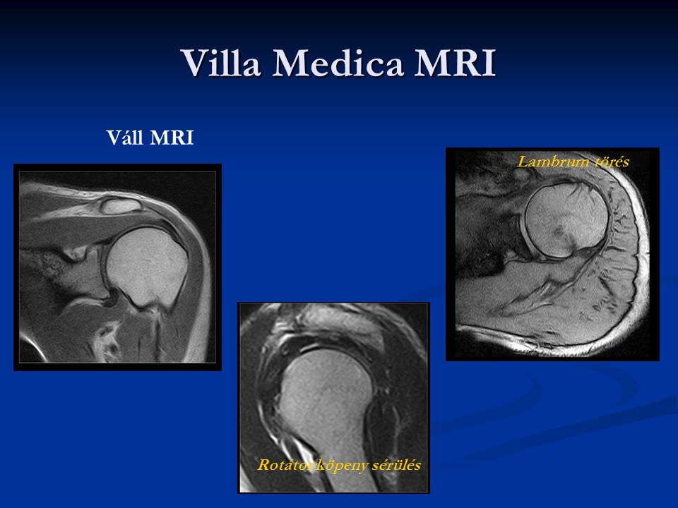 Villa Medica MRI A G scan m gneses rezonanci s vizsg l k sz l k